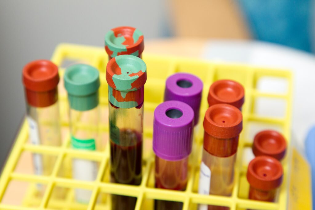 Functional Lab Tests